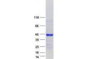 Western Blotting (WB) image for Microtubule-Associated Protein, RP/EB Family, Member 2 (MAPRE2) (Transcript Variant 3) protein (Myc-DYKDDDDK Tag) (ABIN2725485)