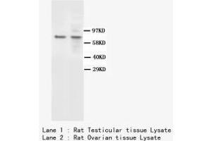 Image no. 1 for anti-BRCA1 Associated Protein-1 (Ubiquitin Carboxy-terminal Hydrolase) (BAP1) antibody (ABIN1502051) (BAP1 抗体)