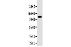 Western Blotting (WB) image for anti-Proprotein Convertase Subtilisin/kexin Type 4 (PCSK4) (AA 117-133), (N-Term) antibody (ABIN3042910) (PCSK4 抗体  (N-Term))