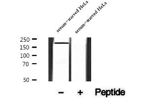 Western blot analysis of extracts of serum-starved HeLa cells, using Phospho-Rictor (Thr1135) Antibody .