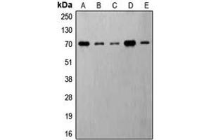 Western blot analysis of S6K1 (pT421) expression in MDAMB231 insulin-treated (A), Jurkat (B), HeLa (C), NIH3T3 (D), PC12 (E) whole cell lysates. (RPS6KB1 抗体  (C-Term, pSer421))