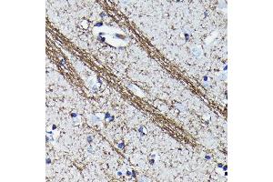 Immunohistochemistry of paraffin-embedded human brain using CNPase Rabbit mAb (ABIN7265322) at dilution of 1:100 (40x lens). (Cnpase 抗体)
