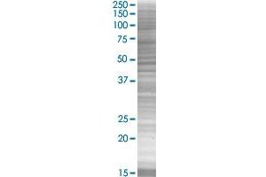 Western Blotting (WB) image for GDNF 293T Cell Transient Overexpression Lysate(Denatured) (ABIN1331941)