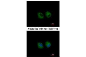 Immunofluorescence (IF) image for anti-Interleukin 1 Receptor, Type II (IL1R2) antibody (ABIN2856630)