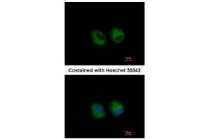 ICC/IF Image Immunofluorescence analysis of methanol-fixed A549, using IL1 Receptor 2, antibody at 1:500 dilution. (IL1R2 抗体)