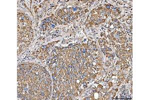 IHC analysis of SUCLG2 using anti-SUCLG2 antibody (ABIN7601694).