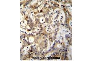 Immunohistochemistry (Paraffin-embedded Sections) (IHC (p)) image for anti-Sp1 Transcription Factor (SP1) (AA 677-707), (C-Term) antibody (ABIN655398)