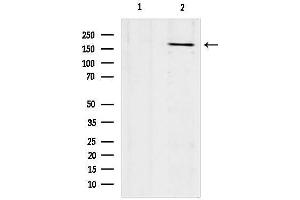Western blot analysis of lysates from mouse brain, using Collagen XVII Antibody.