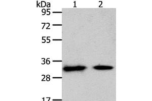 Western Blot analysis of Mouse heart and muscle tissue using SLC25A4 Polyclonal Antibody at dilution of 1:400 (SLC25A4 抗体)