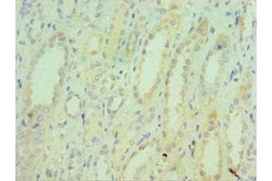 Immunohistochemistry of paraffin-embedded human kidney tissue using ABIN7171754 at dilution of 1:100 (TNXB 抗体  (AA 3933-4242))