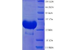 SDS-PAGE (SDS) image for Deiodinase, Iodothyronine, Type III (DIO3) (AA 37-278), (Extracellular) protein (His tag) (ABIN5714130)