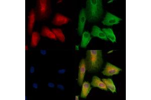 Phospho-WNK1 (Thr60) Antibody staining A549 cells(H2O2 treatment) by IF/ICC.