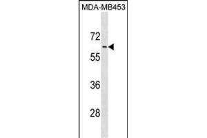 ADRA1B Antibody (C-term) (ABIN1881048 and ABIN2838875) western blot analysis in MDA-M cell line lysates (35 μg/lane). (ADRA1B 抗体  (C-Term))