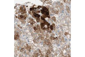 Immunohistochemical staining (Formalin-fixed paraffin-embedded sections) of human adrenal gland with FDFT1 polyclonal antibody  shows strong cytoplasmic positivity in cortical cells. (FDFT1 抗体  (AA 10-148))