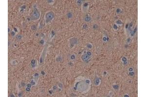 Detection of CAP2 in Human Cerebrum Tissue using Polyclonal Antibody to Adenylyl Cyclase Associated Protein 2 (CAP2) (CAP2 抗体  (AA 1-477))