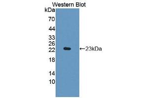 Western blot analysis of the recombinant protein. (IDO 抗体  (AA 26-199))
