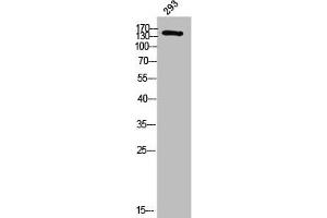 Western Blotting (WB) image for anti-Deleted in Colorectal Carcinoma (DCC) (Internal Region) antibody (ABIN7186518)
