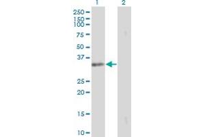 Western Blotting (WB) image for anti-Signal Sequence Receptor, alpha (SSR1) (AA 33-286) antibody (ABIN563010)