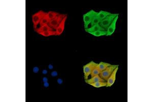 ABIN7095877 and ABIN7099939 staining Hela cells by IF/ICC. (PLA2G12B 抗体)