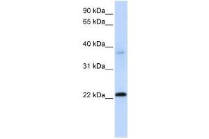 Western Blotting (WB) image for anti-Chromosome 11 Open Reading Frame 74 (C11ORF74) antibody (ABIN2459550) (C11ORF74 抗体)