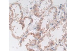 Used in DAB staining on fromalin fixed paraffin- embedded Kidney tissue (Deoxyribonuclease II (AA 19-360) 抗体)