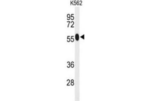 Western Blotting (WB) image for anti-Acyl-CoA Synthetase Medium-Chain Family Member 1 (ACSM1) antibody (ABIN3004114) (ACSM1 抗体)