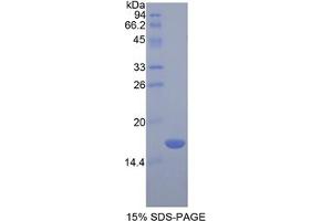 SDS-PAGE analysis of Rat Chemerin Protein. (Chemerin 蛋白)