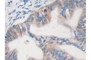 Immunohistochemistry (IHC) image for anti-Major Vault Protein (MVP) (AA 2-272) antibody (ABIN7441988)