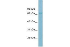 Image no. 1 for anti-Solute Carrier Family 27 (Fatty Acid Transporter), Member 5 (SLC27A5) (AA 611-660) antibody (ABIN6741651)