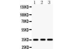 Western Blotting (WB) image for anti-Insulin-Like Growth Factor Binding Protein 2, 36kDa (IGFBP2) (AA 228-257), (C-Term) antibody (ABIN3043858) (IGFBP2 抗体  (C-Term))