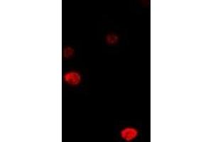 Immunofluorescent analysis of DCK staining in MCF7 cells. (DCK 抗体)