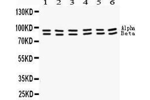 Western Blotting (WB) image for anti-Signal Transducer and Activator of Transcription 1, 91kDa (STAT1) (AA 114-143), (N-Term) antibody (ABIN3043938) (STAT1 抗体  (N-Term))