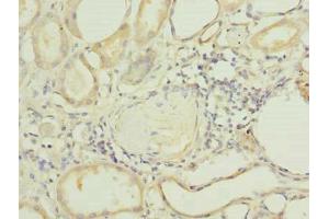 Immunohistochemistry (IHC) image for anti-Pleckstrin Homology Domain Containing, Family A (Phosphoinositide Binding Specific) Member 8 (PLEKHA8) (AA 1-300) antibody (ABIN7163641)