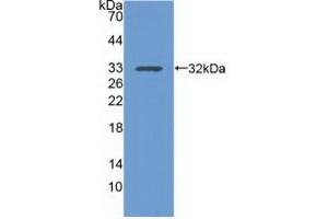 Western blot analysis of the recombinant protein. (Integrin alpha 1 抗体  (AA 125-366))