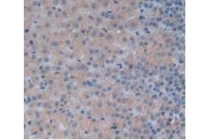 Detection of IL24 in Rat Adrenal Gland Tissue using Monoclonal Antibody to Interleukin 24 (IL24) (IL-24 抗体  (AA 29-183))