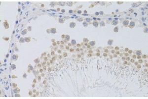 Immunohistochemistry of paraffin-embedded Rat testis using PHC1 Polyclonal Antibody at dilution of 1:100 (40x lens). (PHC1 抗体)