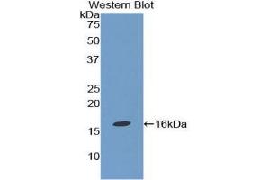 Western blot analysis of the recombinant protein. (TGFB1 抗体  (AA 279-390))