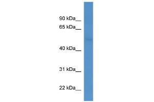 Western Blotting (WB) image for anti-Coronin, Actin Binding Protein, 2B (CORO2B) (C-Term) antibody (ABIN2784791)