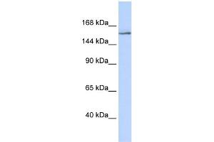 WB Suggested Anti-NCOA3 Antibody Titration:  0. (NCOA3 抗体  (Middle Region))