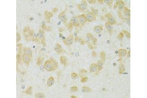 Immunohistochemistry of paraffin-embedded Rat brain using SLC37A4 Polyclonal Antibody at dilution of 1:100 (40x lens). (SLC37A4 抗体)