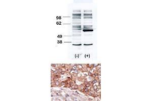 Image no. 2 for anti-B Lymphoid Tyrosine Kinase (BLK) (N-Term) antibody (ABIN359972) (BLK 抗体  (N-Term))