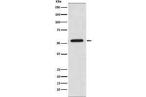 Western blot analysis of CaMKII expression in HeLa cell lysate.