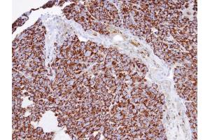 IHC-P Image Immunohistochemical analysis of paraffin-embedded Huh7 xenograft, using INPP1 , antibody at 1:100 dilution.