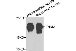 Western blot analysis of extracts of various cell lines, using TNNI2 antibody (ABIN5975229) at 1/1000 dilution. (TNNI2 抗体)