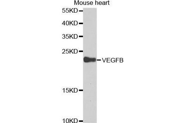 VEGFB 抗体  (AA 100-200)