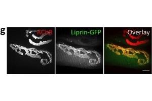 Immunofluorescence (Paraffin-embedded Sections) (IF (p)) image for anti-Protein Tyrosine Phosphatase F Interacting Protein 1 (PPFIA1) (N-Term) antibody (ABIN2856986)
