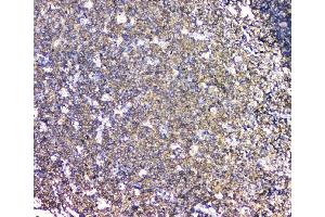 anti-Lymphocyte Cytosolic Protein 1 (LCP1) antibody