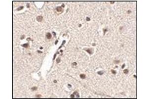 Immunohistochemistry of Rkhd4 in human brain tissue with this product at 2. (MEX3A 抗体  (C-Term))