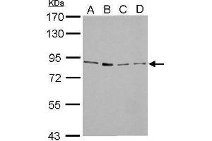 WB Image FOXM1 antibody detects FOXM1 protein by Western blot analysis. (FOXM1 抗体)