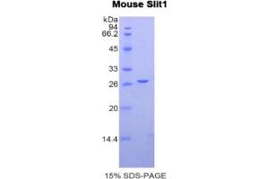 SDS-PAGE (SDS) image for Slit Homolog 1 (SLIT1) ELISA Kit (ABIN6574315)
